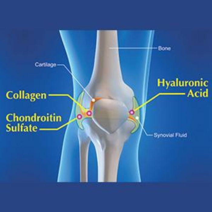 chondroitin sulfate